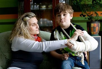 Uczeń podstawówki złamał koledze rękę. Ze szkoły na salę operacyjną